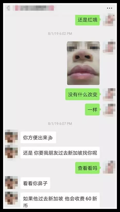 勿貪小便宜!找「微整師」整鼻,還附送「無痕酒窩」 ,結果她中招了!