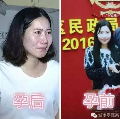 老婆懷孕五個月變醜,丈夫覺得好惡心離家出走!