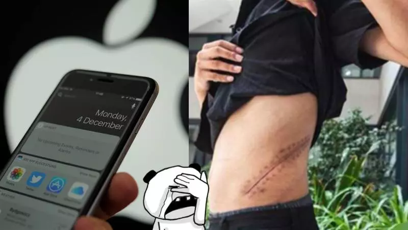 賣腎買iPhone!17歲高中生「剩一顆腎」7年後慘況曝光