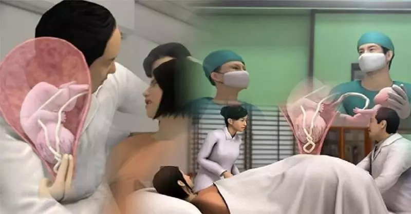 小兒子沒有生育能力, 婆婆讓二兒子借精子, 沒想到孩子生下來後卻越長越像…從此家無寧日!