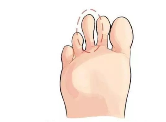 你的哪個腳趾最長?測出你十年後的社會地位!超凖