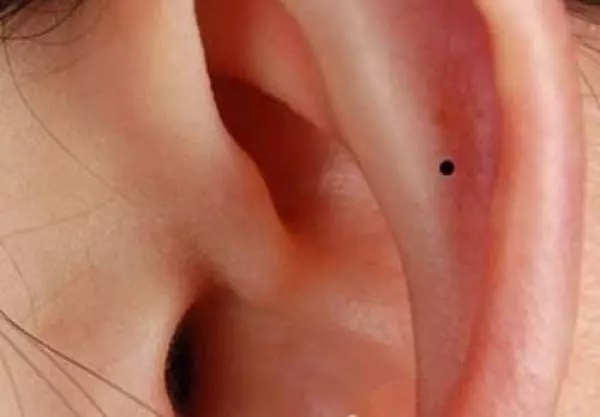 看看你身上這10處有痣嗎?只要有一個,恭喜你了,今生註定發達!
