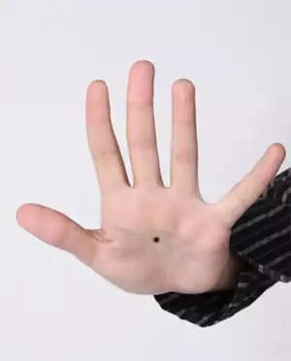 看看你身上這10處有痣嗎?只要有一個,恭喜你了,今生註定發達!