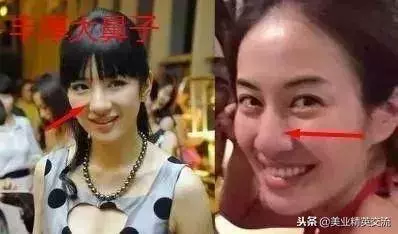 鼻子上有這根線的女子,好老婆面相,一般人娶不到 !