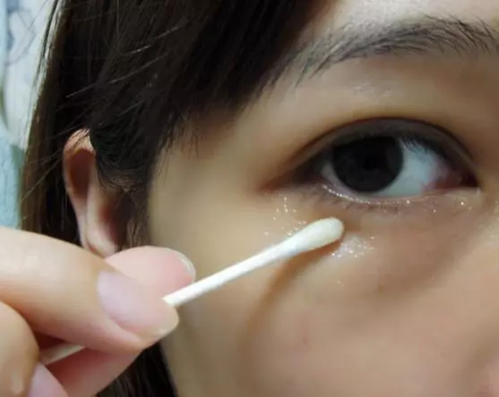 女人有眼袋就打玻尿酸?別傻了,抹點廚房便宜貨,15天撫平眼袋