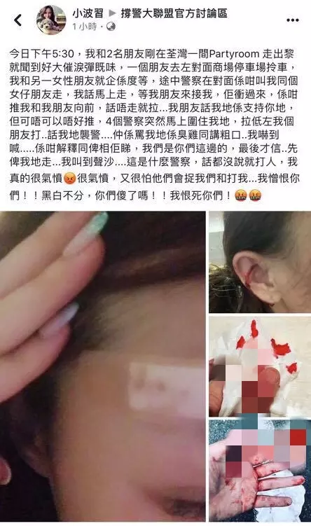 挺港警被打到頭破血流! 電眼正妹爆怒:黑白不分傻了嗎 |