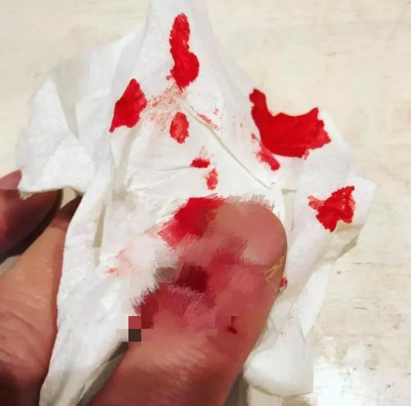 挺港警被打到頭破血流! 電眼正妹爆怒:黑白不分傻了嗎 |