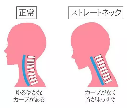 烏龜頸毀全部!一套簡單動作,只需2分鐘改善「頸部前傾」問題