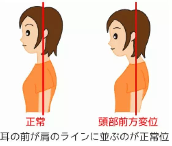 烏龜頸毀全部!一套簡單動作,只需2分鐘改善「頸部前傾」問題