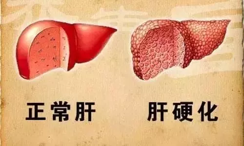 睡前抬抬腳,全身百病消,每天15分鐘,抬走三高,抬出健康,安心睡到大天亮