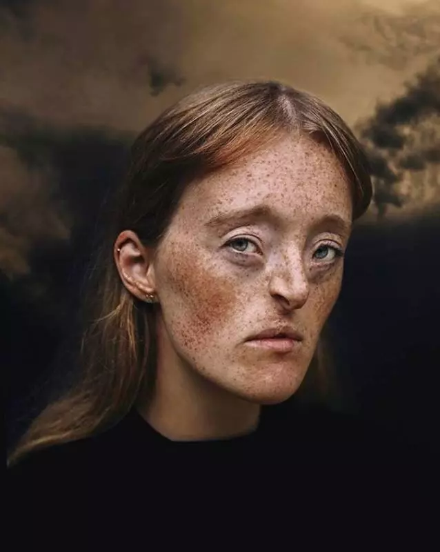 擁有貓眼的小男孩！11個你一生只可能遇到一次的「稀有身體特徵」獨特人!