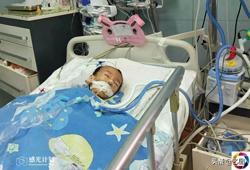 3歲男童術後渾身插滿管子,體重僅剩15.6斤,看見爸媽就流淚