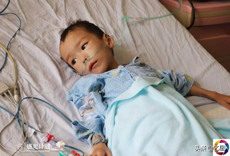 3歲男童術後渾身插滿管子,體重僅剩15.6斤,看見爸媽就流淚