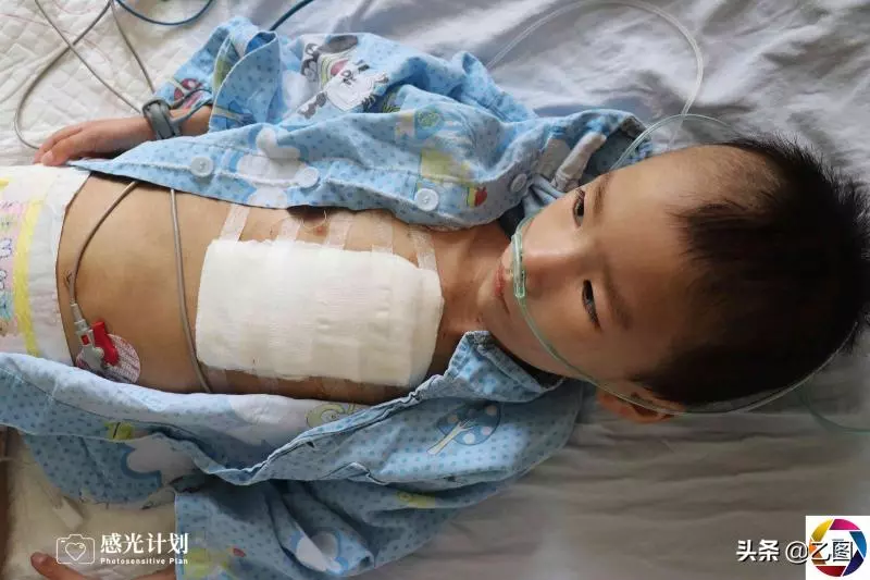 3歲男童術後渾身插滿管子,體重僅剩15.6斤,看見爸媽就流淚