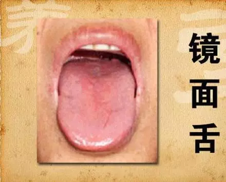 脾虛的女人會變醜!養臉不如先養脾~食療調脾虛,吃出健康好氣色 !