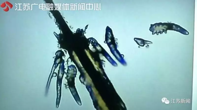 嚇人!女白領眼睛干癢還掉睫毛,竟因這東西在裡面安了家 !