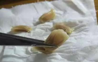 吃剩的蘋果、長芽的馬鈴薯千萬別扔!還有大用處呢!