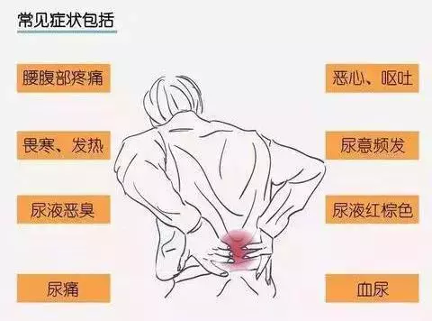腎結石與水垢有關系嗎?看完才能放心!附:最省錢的預防妙招 !