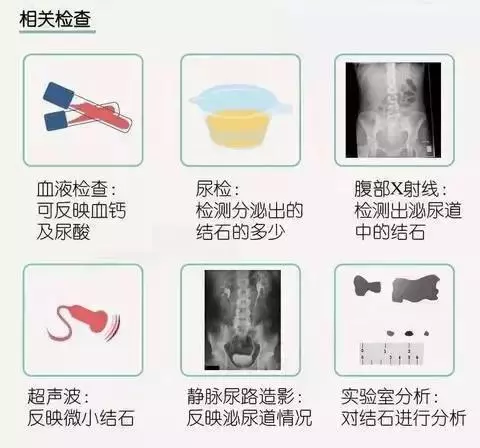 腎結石與水垢有關系嗎?看完才能放心!附:最省錢的預防妙招 !
