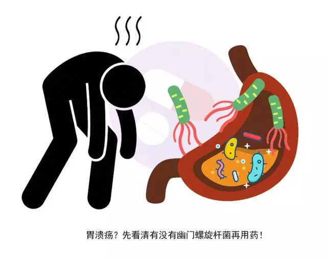 胃痛怎麼用藥?醫生:不同胃病用藥方法也不同,教你3個用藥竅門 !