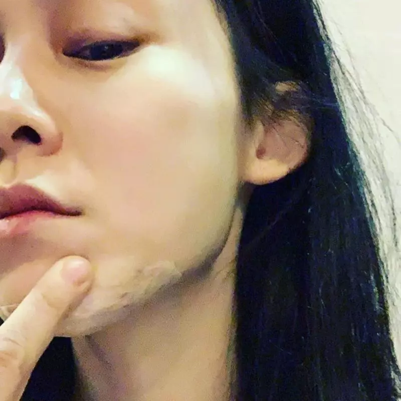 驚悚!范范摔傷縫15針 下巴挖掀一塊肉 | 電視 | 噓!星聞