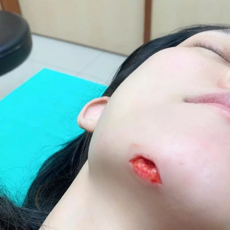 驚悚!范范摔傷縫15針 下巴挖掀一塊肉 | 電視 | 噓!星聞
