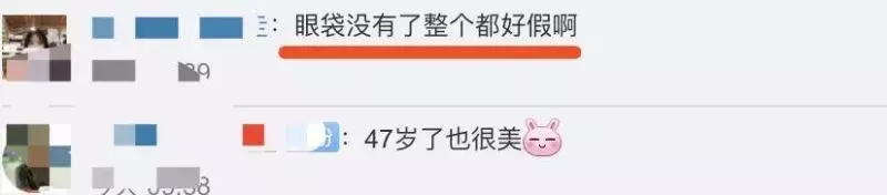 48歲黎姿曬近照,臥蠶眼袋全消失,網友:別再打針了!