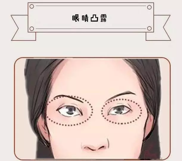 女人5種苦夫相,結婚嫁窮人,命薄福淺,晚年沒有落腳處!