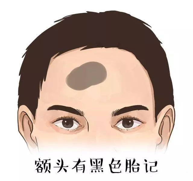 額頭上長了痣、斑、和胎記的人,命運到底好不好 ?
