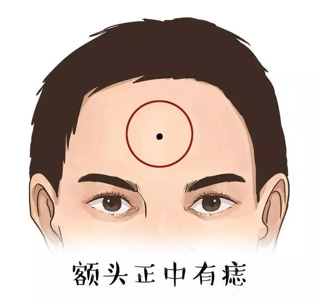 額頭上長了痣、斑、和胎記的人,命運到底好不好 ?