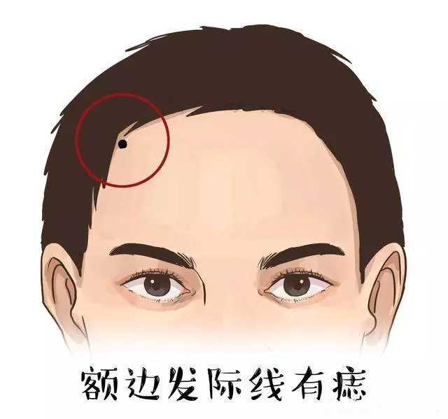 額頭上長了痣、斑、和胎記的人,命運到底好不好 ?