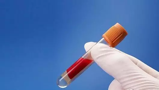 晚飯吃錯了跟肥胖、脂肪肝和血糖都有關?幾個注意事項一次說清楚