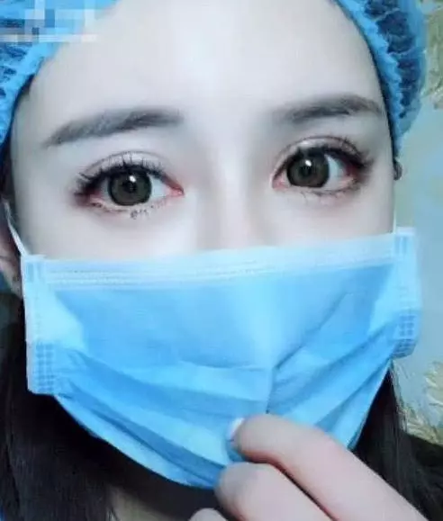 女孩自爆「整形失敗嘴巴超醜」,拉下口罩網友驚呼:簡直是被上帝眷顧的女人!就算失敗我也娶!