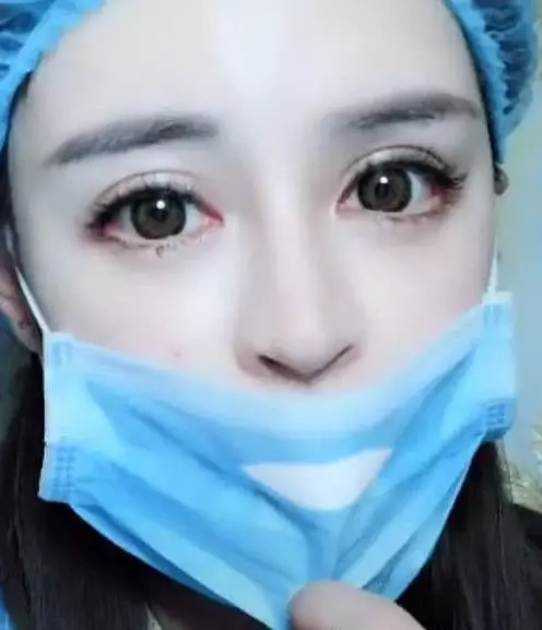 女孩自爆「整形失敗嘴巴超醜」,拉下口罩網友驚呼:簡直是被上帝眷顧的女人!就算失敗我也娶!