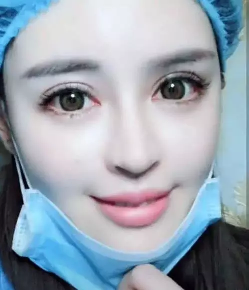 女孩自爆「整形失敗嘴巴超醜」,拉下口罩網友驚呼:簡直是被上帝眷顧的女人!就算失敗我也娶!