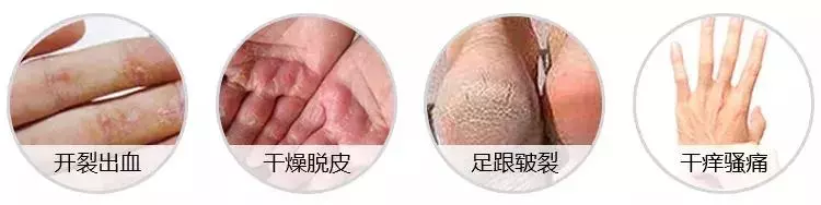 女人的體面要從腳開始:腳糙死皮還乾裂?南非小綠瓶塗一塗准好