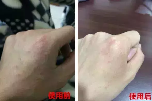 女人的體面要從腳開始:腳糙死皮還乾裂?南非小綠瓶塗一塗准好