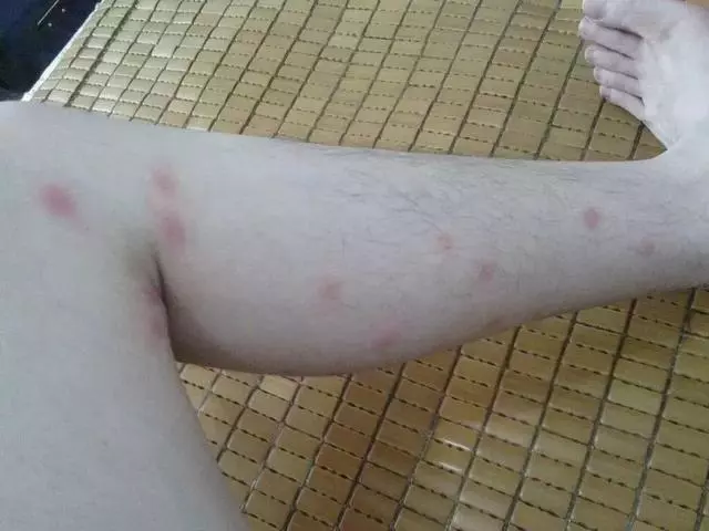女人的體面要從腳開始:腳糙死皮還乾裂?南非小綠瓶塗一塗准好