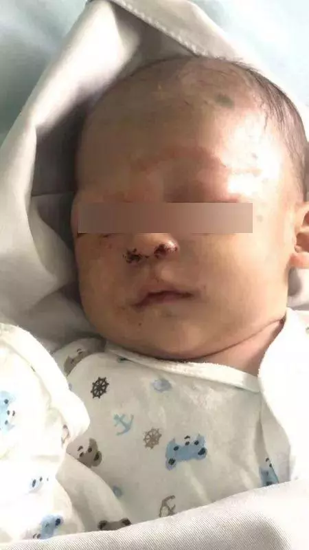 痛心!滿月嬰兒被棄雜草中,民警將他抱起時,面部爬滿螞蟻