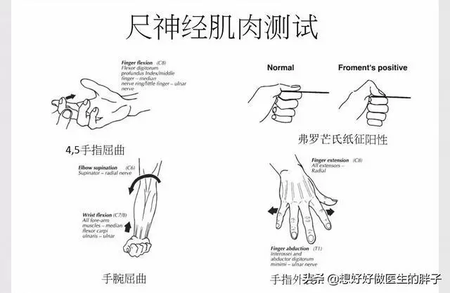 手指麻木疼痛,夜間加重,白天減輕,很可能是這兩種問題惹的禍