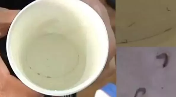 女人一漱口就吐出大量黑蟲,老公和孩子都再也不敢接近她...到醫院檢查後,醫生給的答案讓她徹底崩潰!