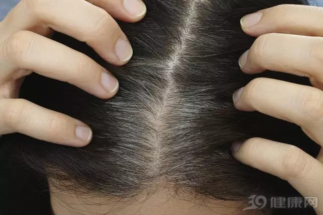 白髮拔一根長十根,是真的嗎?想讓白髮變少,做4件事才實在 !