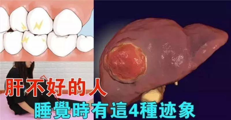 肝不好,睡覺時,會有這4種跡象,你若佔1個,說明你「肝功能」已經很差了