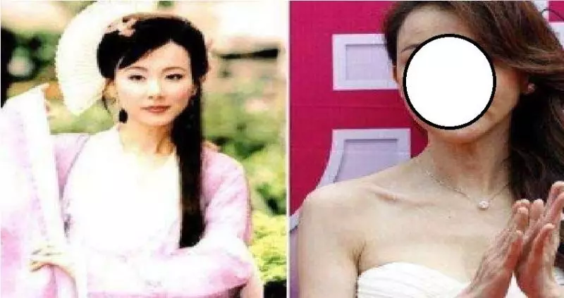 最不該整容的五個女星:蕭薔令人最可惜,最後一個整不整都一樣
