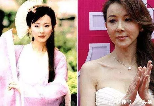 最不該整容的五個女星:蕭薔令人最可惜,最後一個整不整都一樣