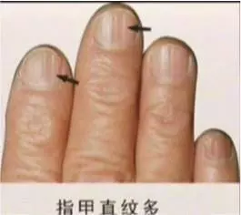 你的「壽命」有多長?你的「手指頭」已經悄悄暴露給別人知道了 !