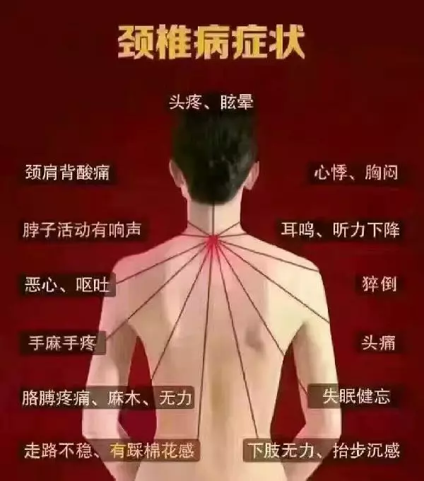 頸椎病的早期症狀,會對患者的日常生活產生一定的影響