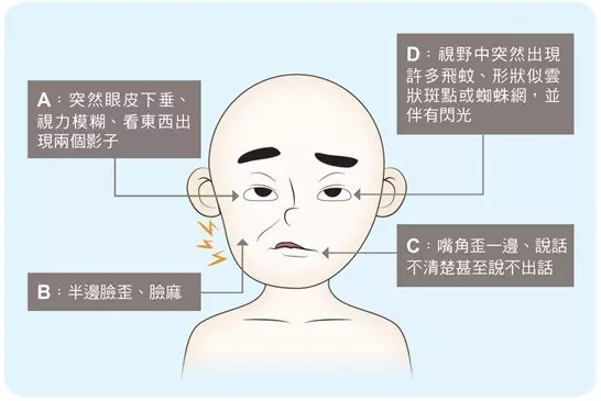 一刻都不能等!台大醫師:出現這17種症狀,請馬上去急診 -
