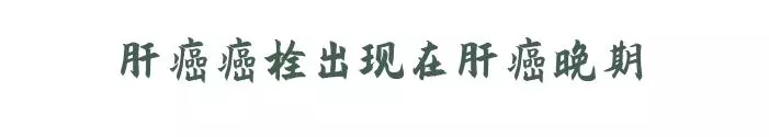 生存期僅4個月!肝癌晚期合併癌栓,他是如何治好的?