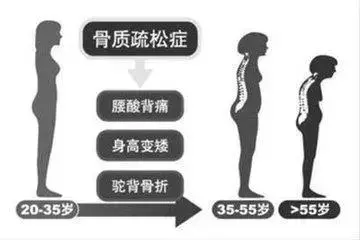 骨科大夫送您一份骨骼保養秘籍
